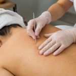 Gloved esthetician performing extractions during a back treatment, focusing on hands and upper back.
